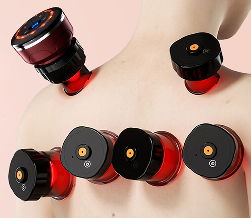 UBALANCE Smart Cupping Therapy Set
